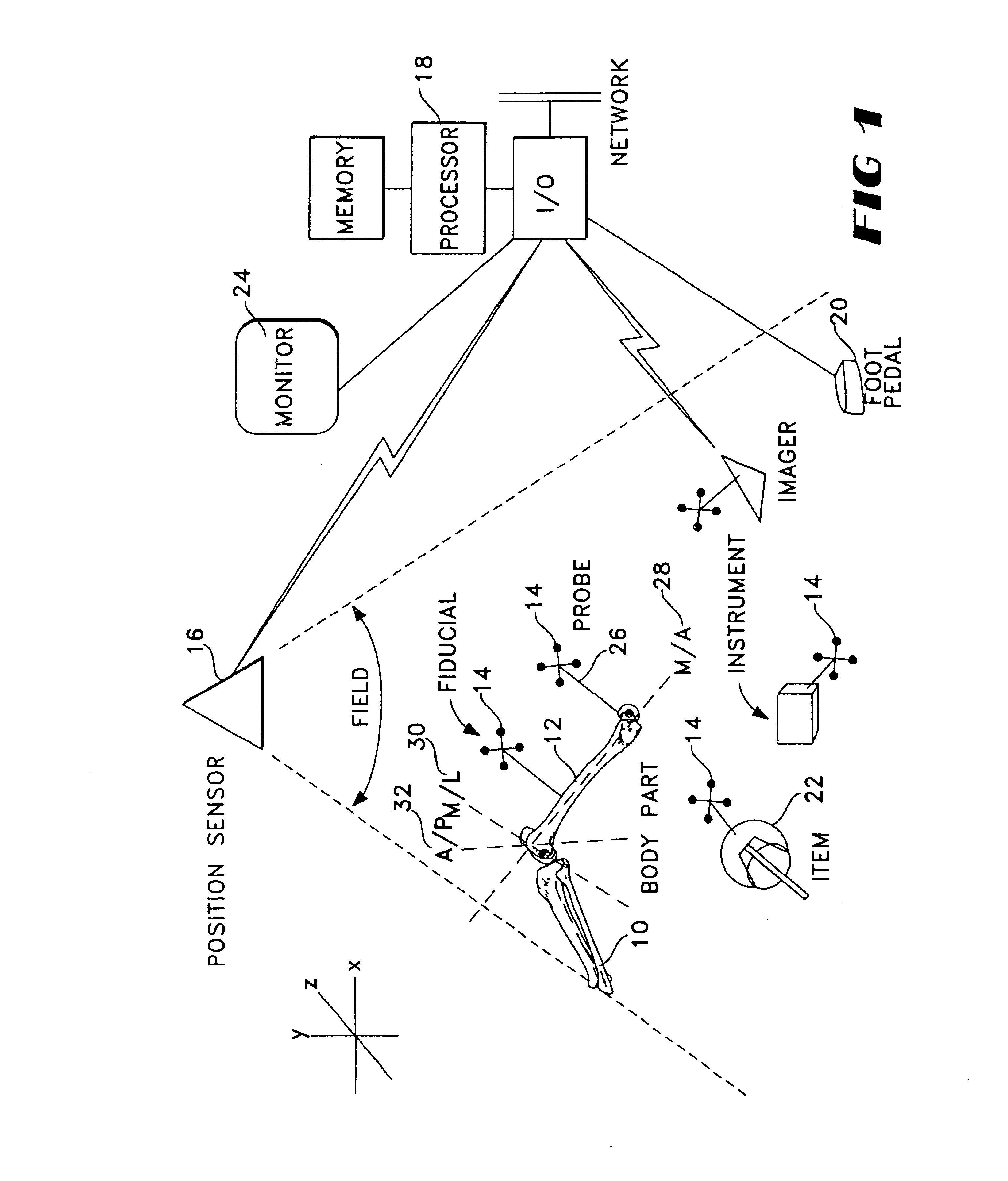 Total knee arthroplasty systems and processes