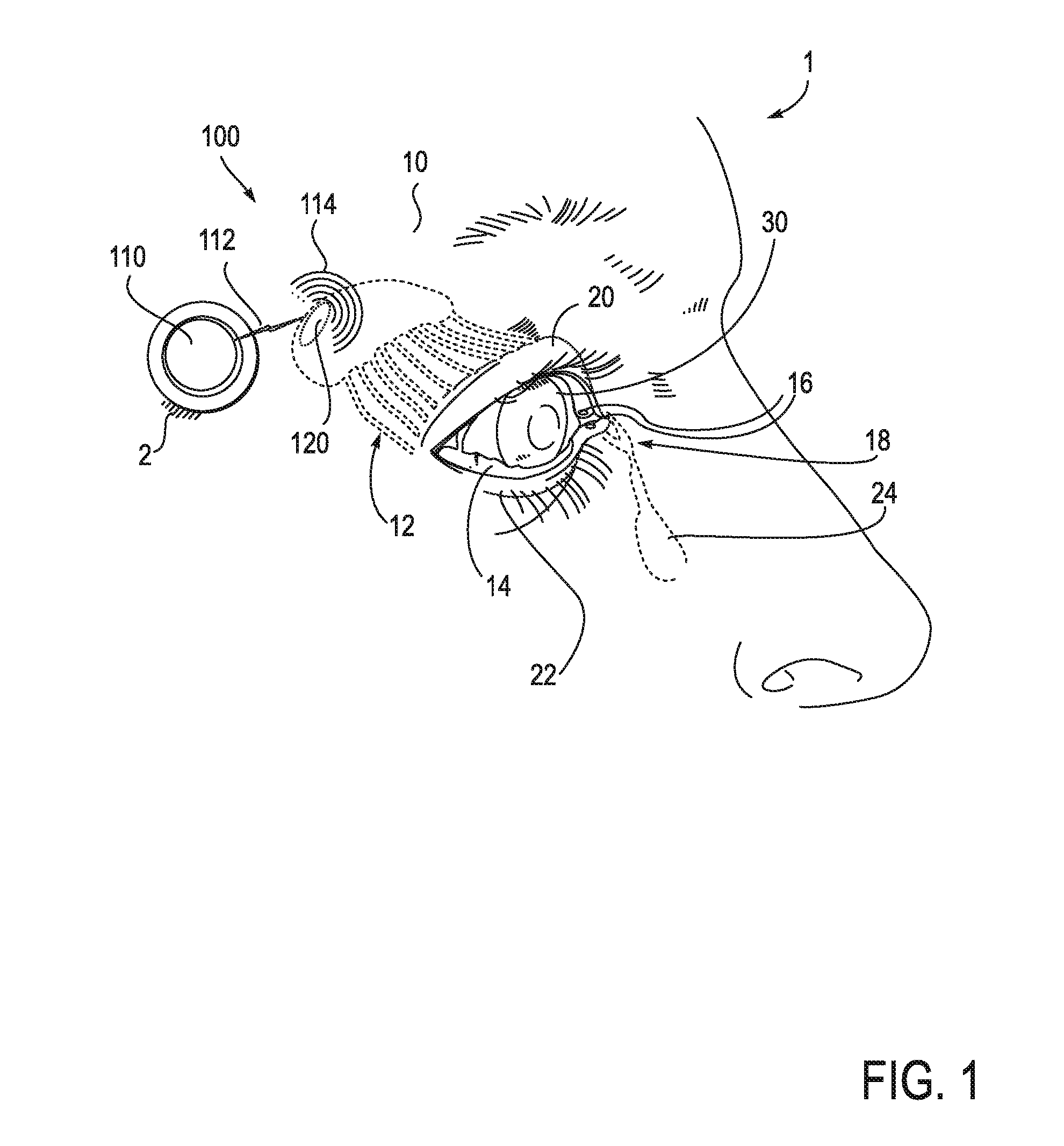 Systems and methods for treatment of dry eye