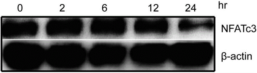 Expression regulation reagent of NFATc3 and screening kit based on arsenical-sensitive cells of NFATc3