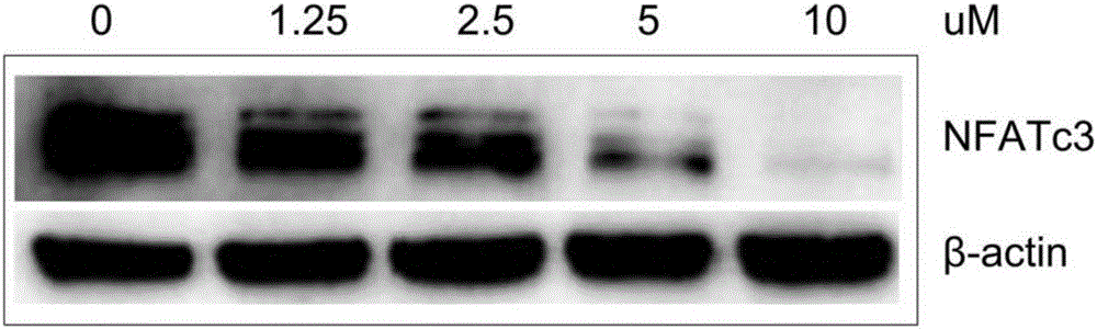 Expression regulation reagent of NFATc3 and screening kit based on arsenical-sensitive cells of NFATc3