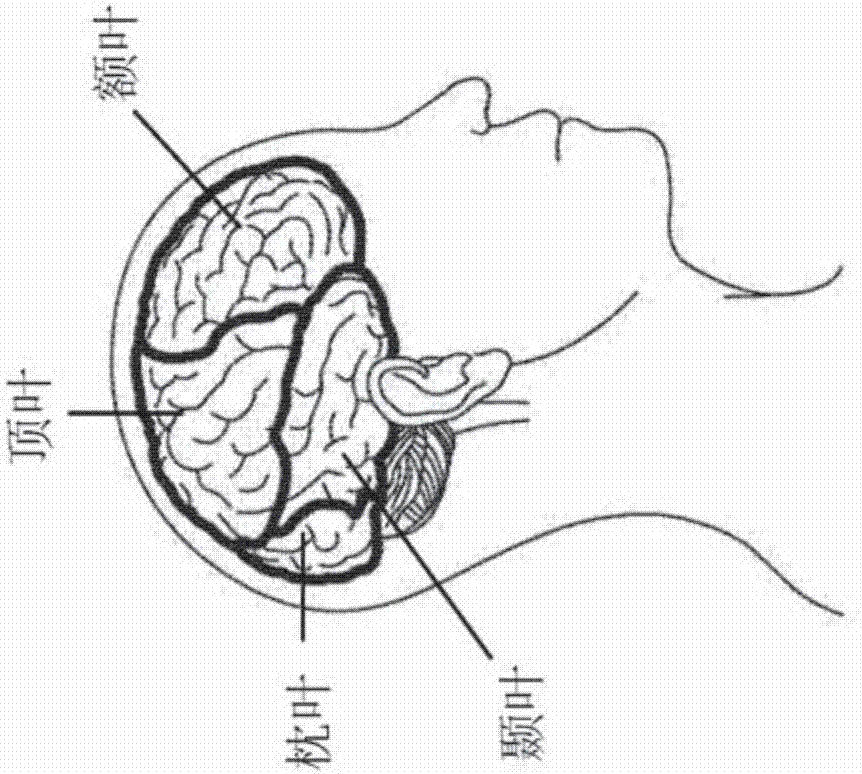 Wearable physiological activity sensor, sensing device and sensing system