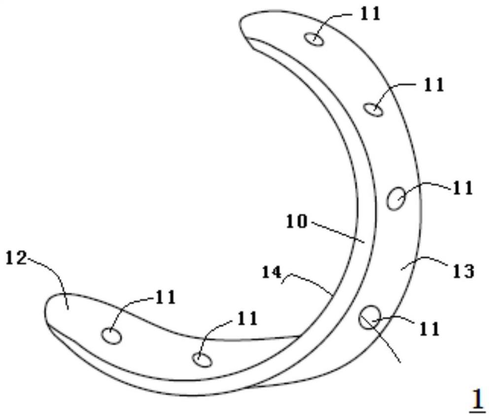 Trachea expansion device and preparation method therefor