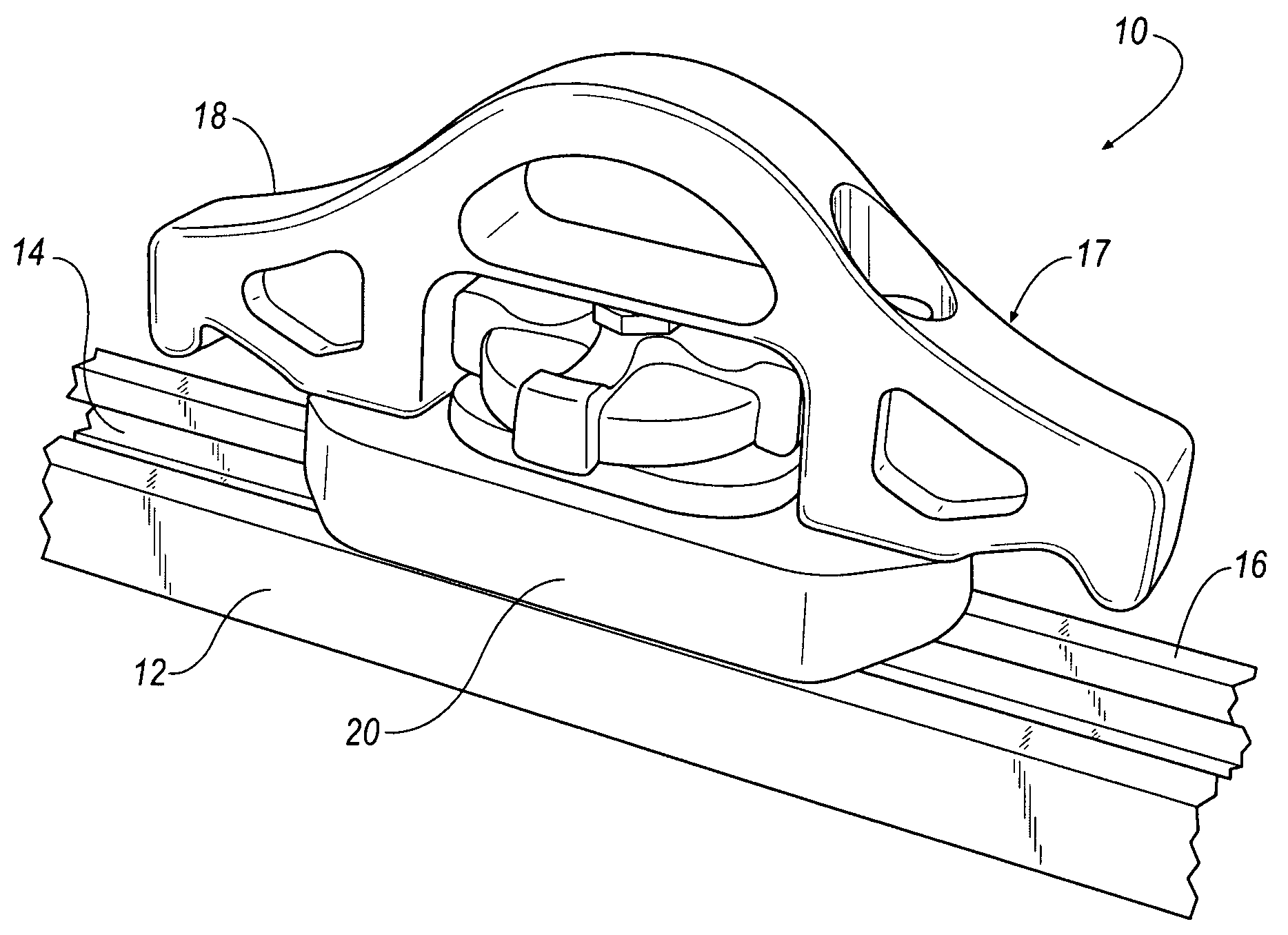 Securement mechanism