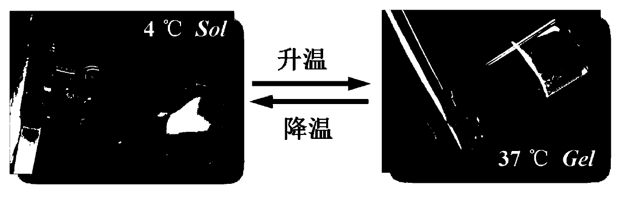 A temperature-sensitive injectable postoperative anti-adhesion material and its preparation method