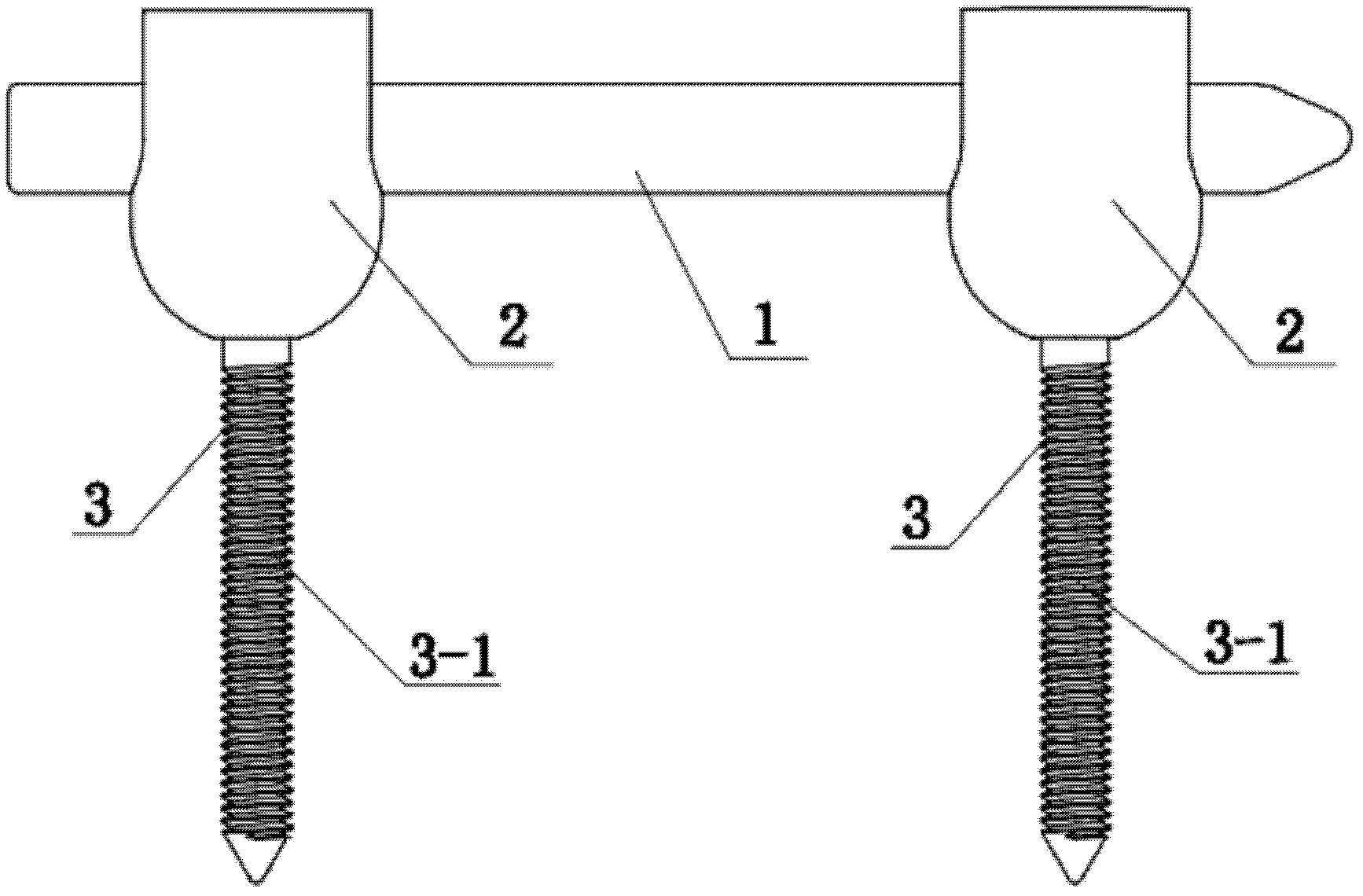 Universal vertebral pedicle screw system capable of moving slightly