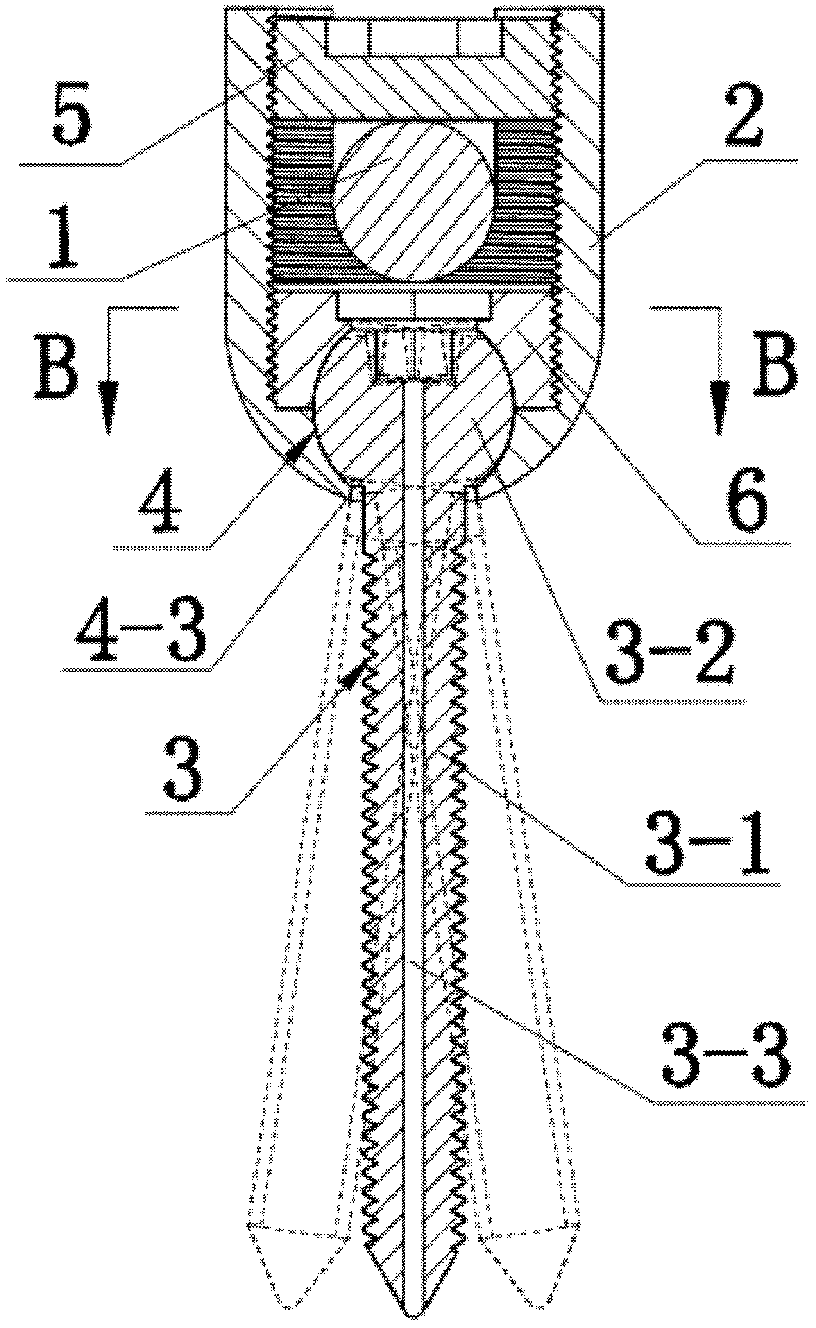 Universal vertebral pedicle screw system capable of moving slightly