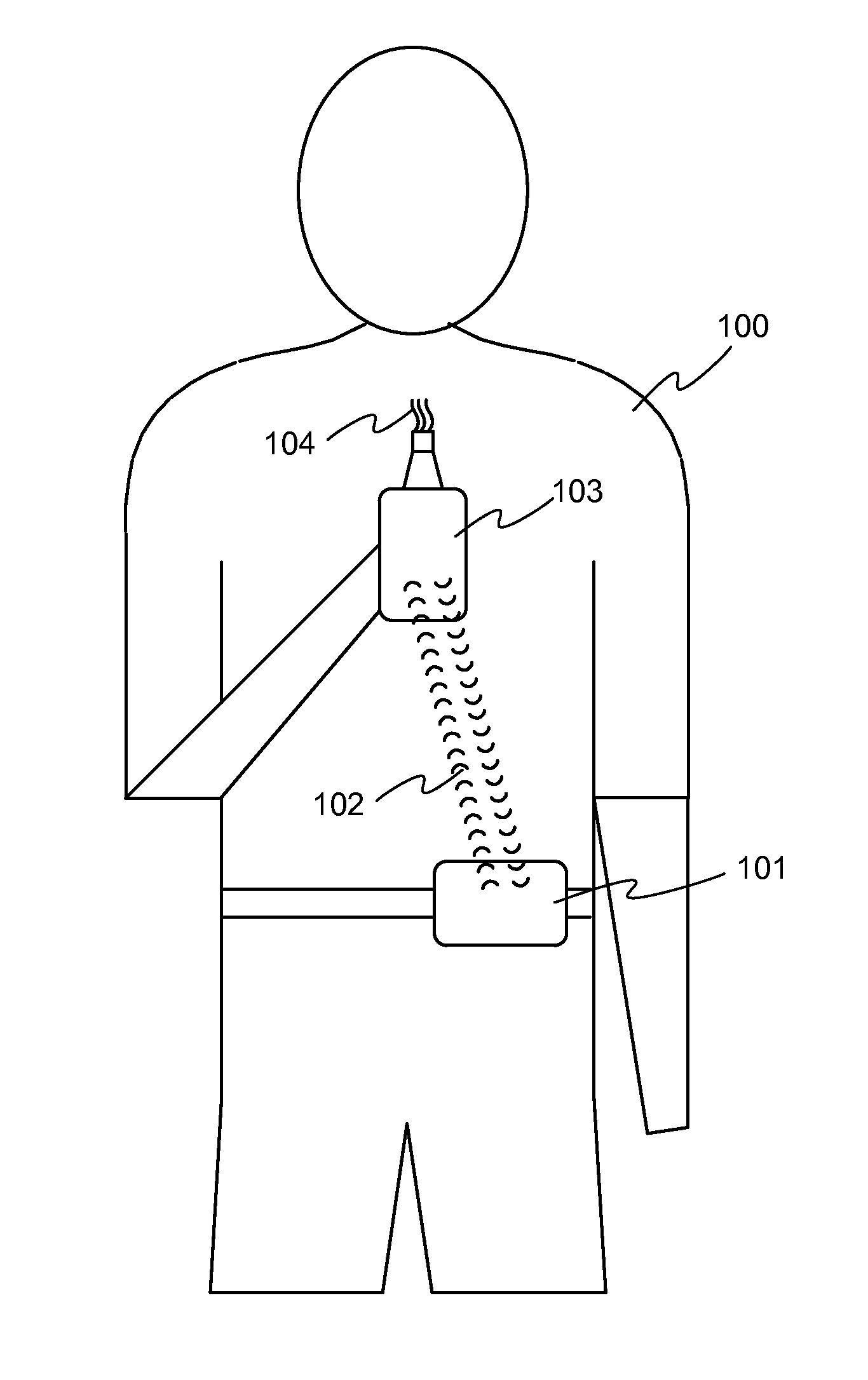 Integration of glucose data to adjust inhaled insulin dose