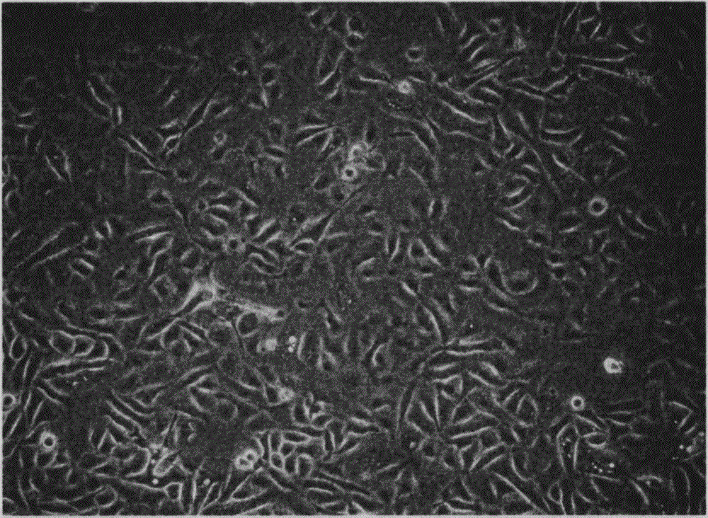 In vitro culture method of cervical intraepithelial neoplasia cells