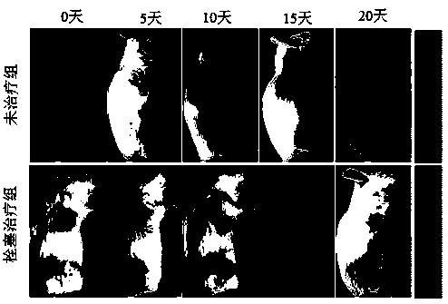 PH-reduction dual-response polymer embolization agent for tumor catheter-free embolization and synthesis thereof