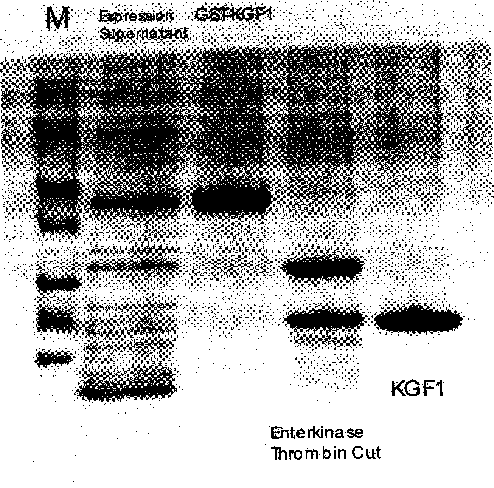 Recombinant human keratinized cell growth factor production method