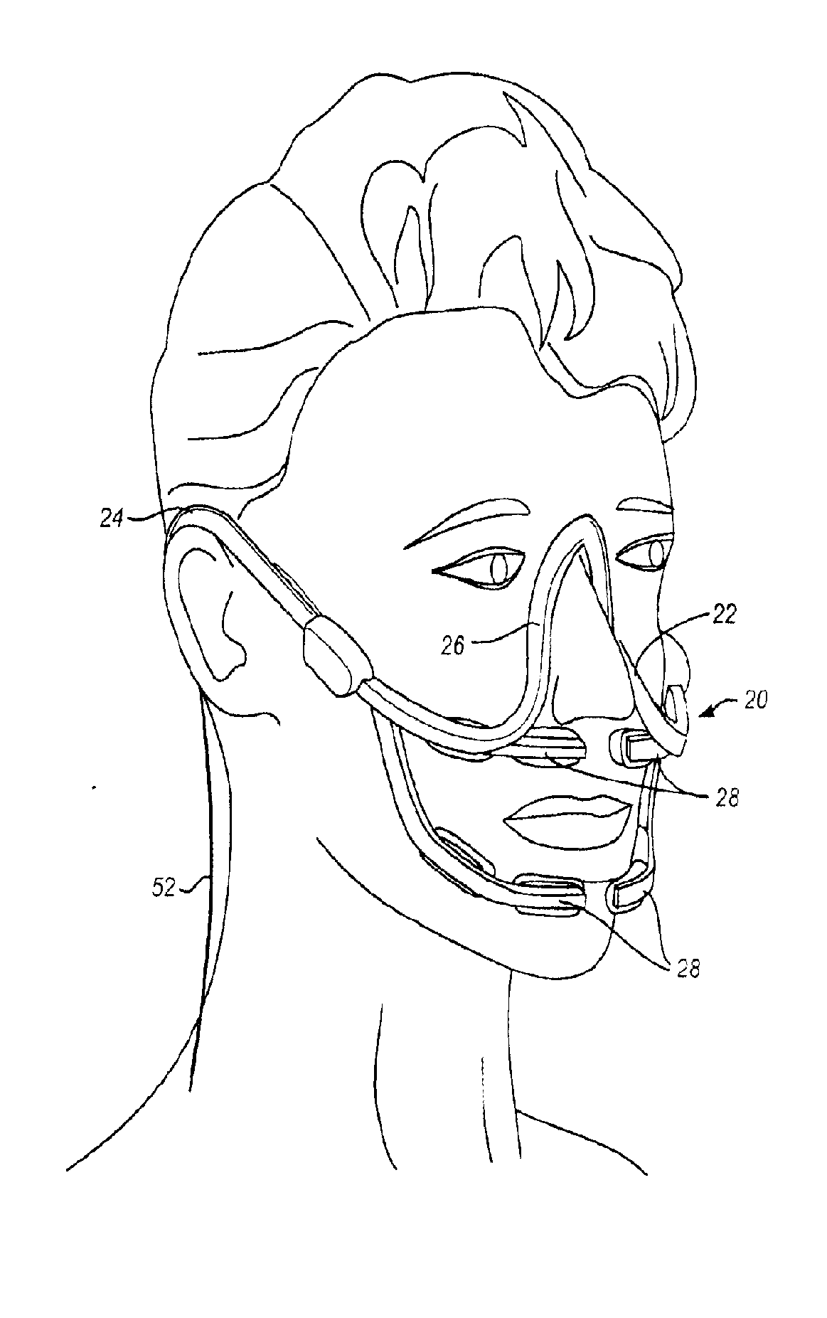 Method and apparatus for tooth regulation with heavy forces