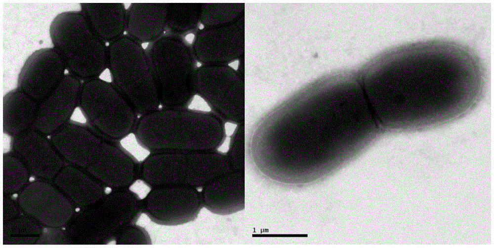 High-efficiency algae-inhibiting active compound deinoxanthin and its preparation method and application