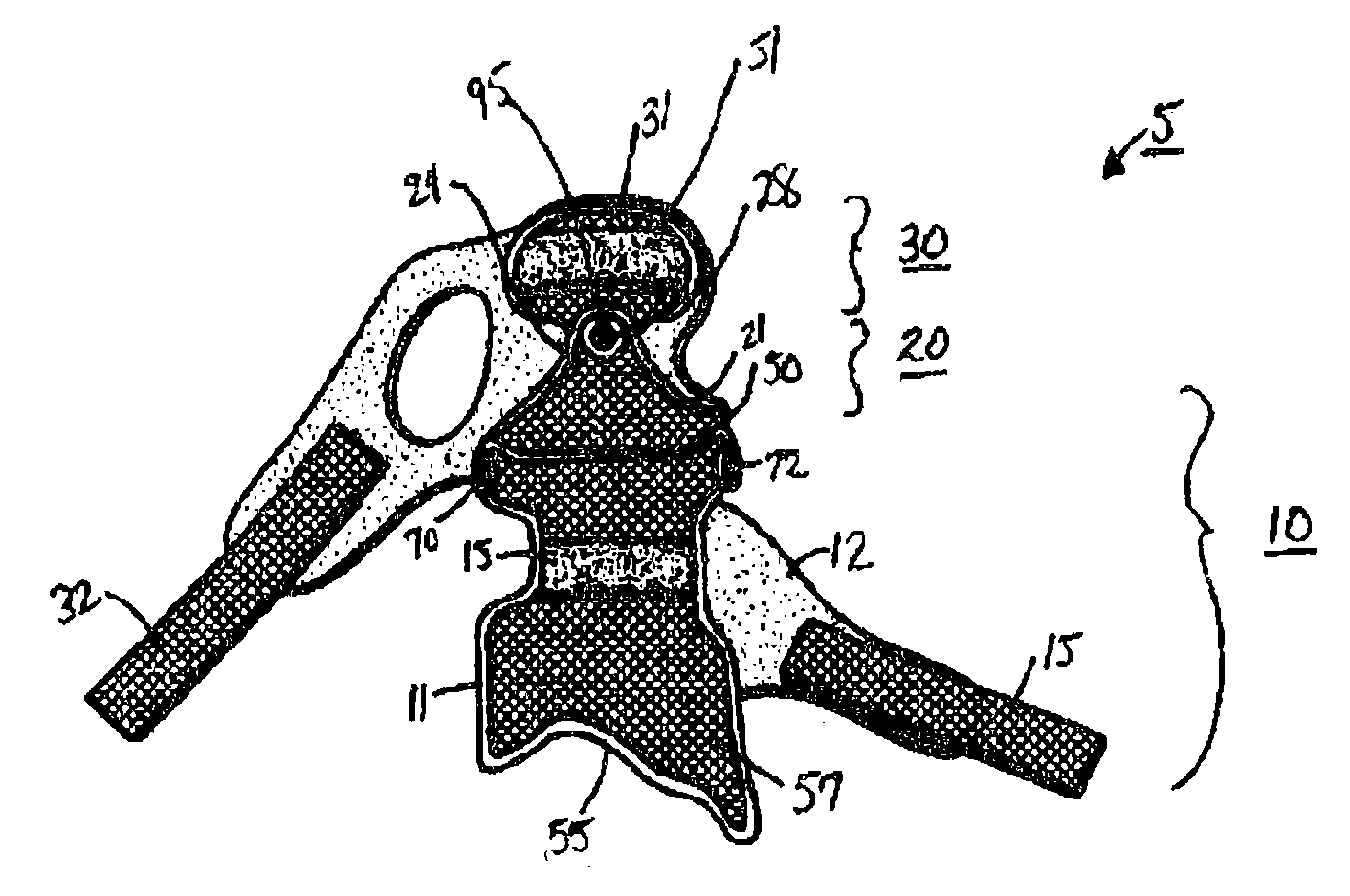 Orthotic protective device