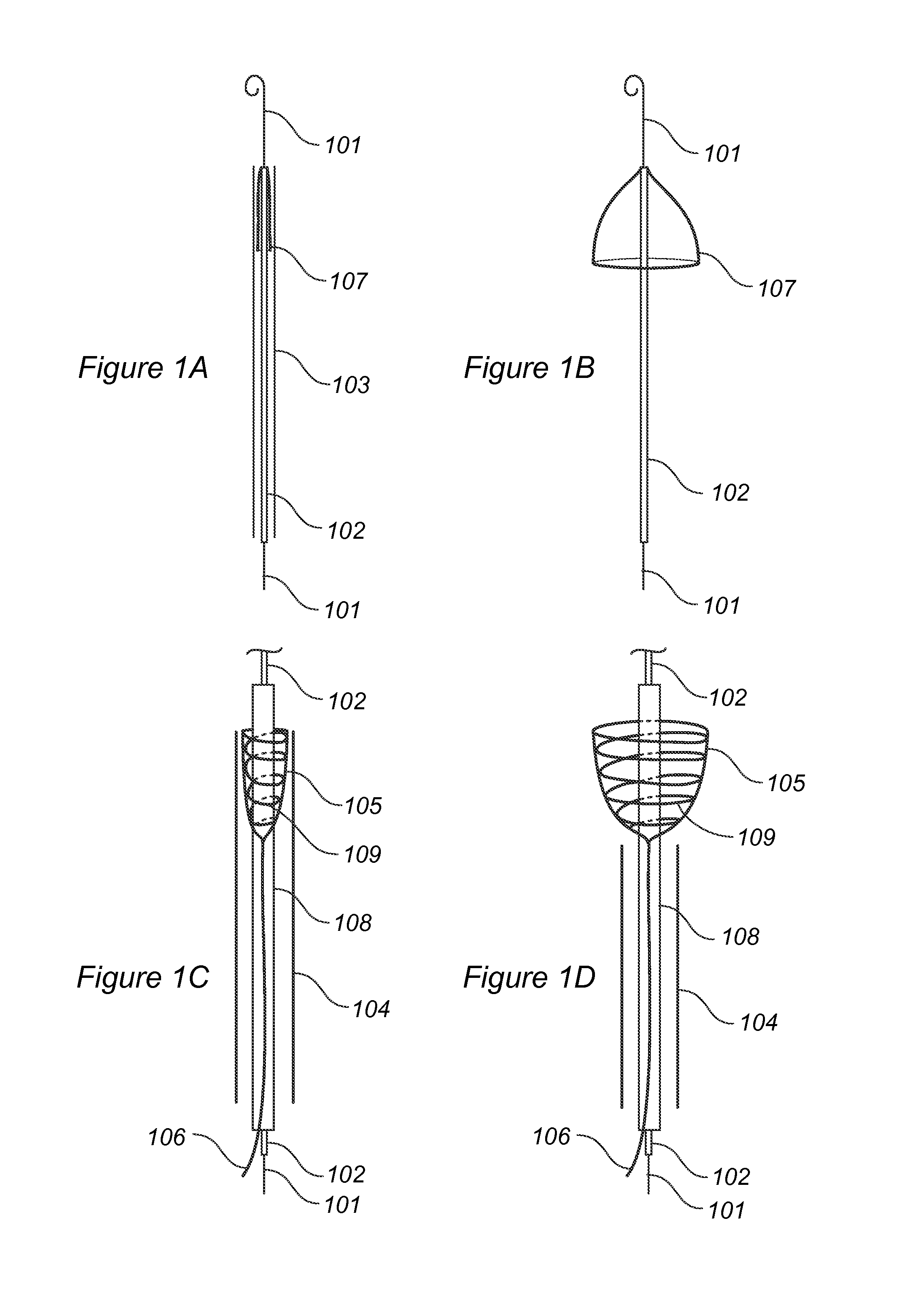 Device to percutaneously treat heart valve embolization