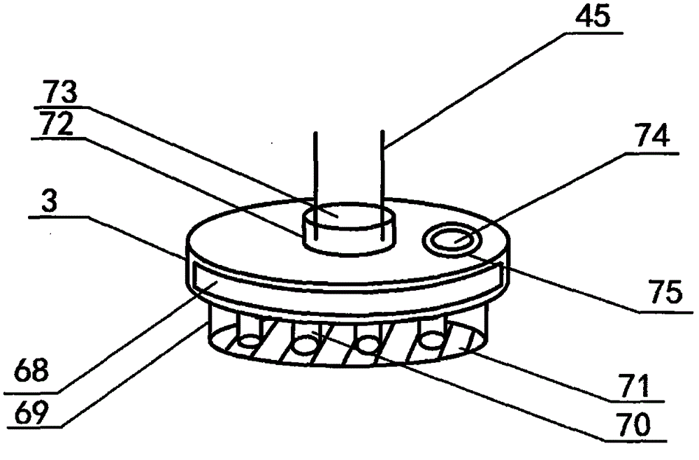 Microwave therapy apparatus for obstetrics and gynecology department