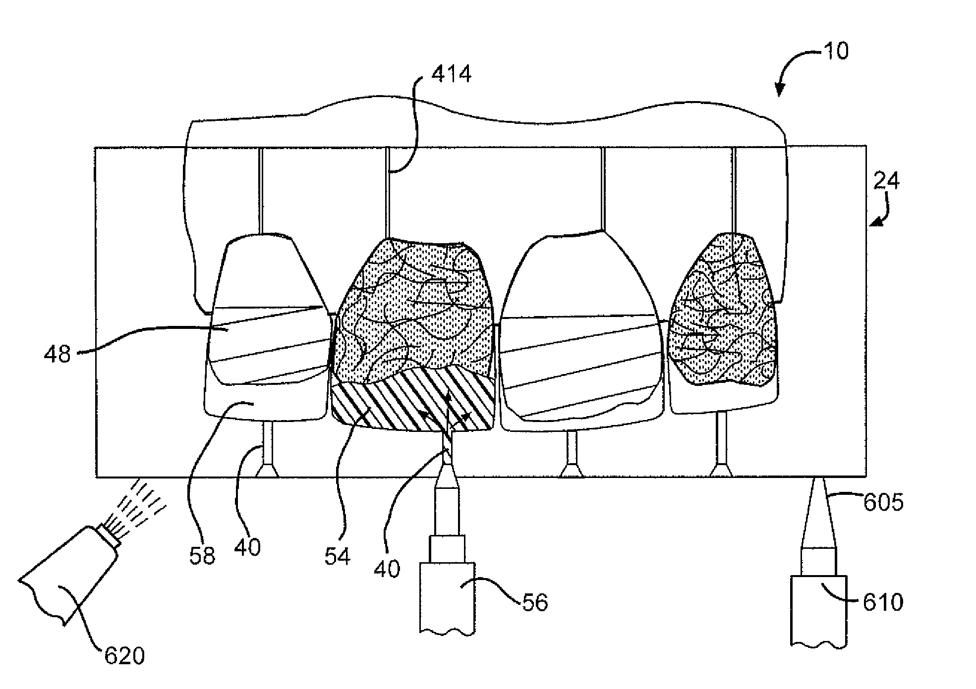 Method for dental restoration and related kit