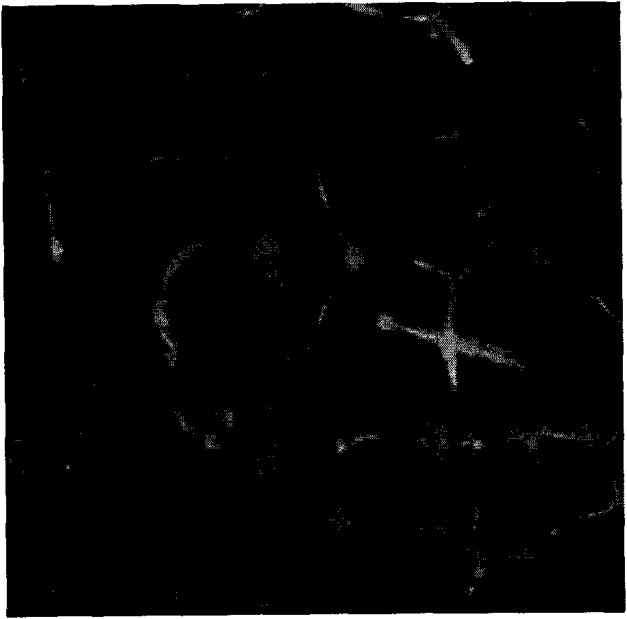 II type collagen sponge bracket and uses thereof