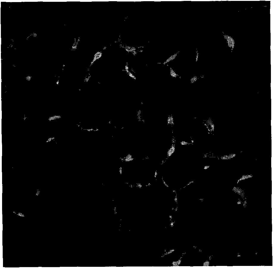 II type collagen sponge bracket and uses thereof