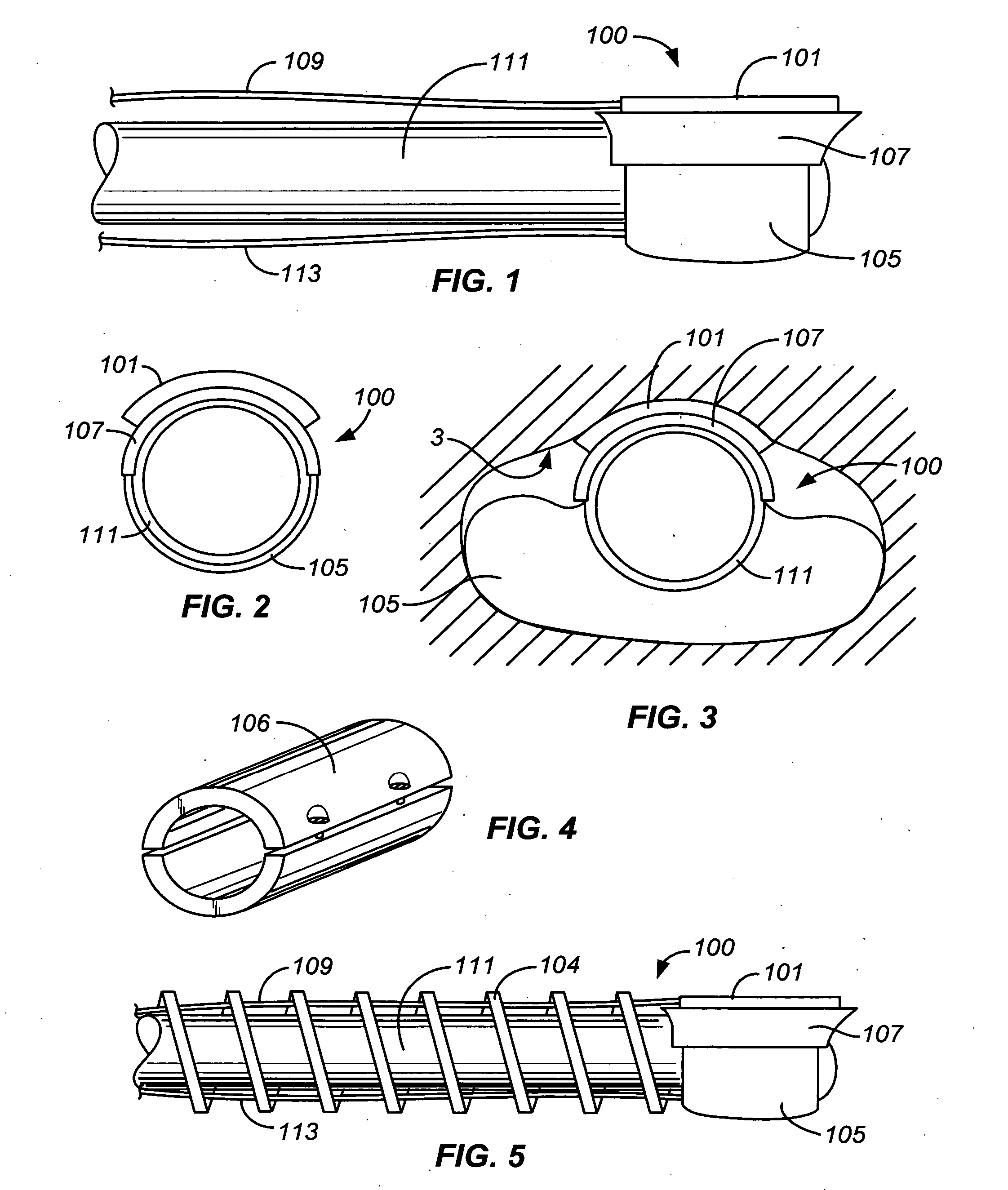 Precision ablating method