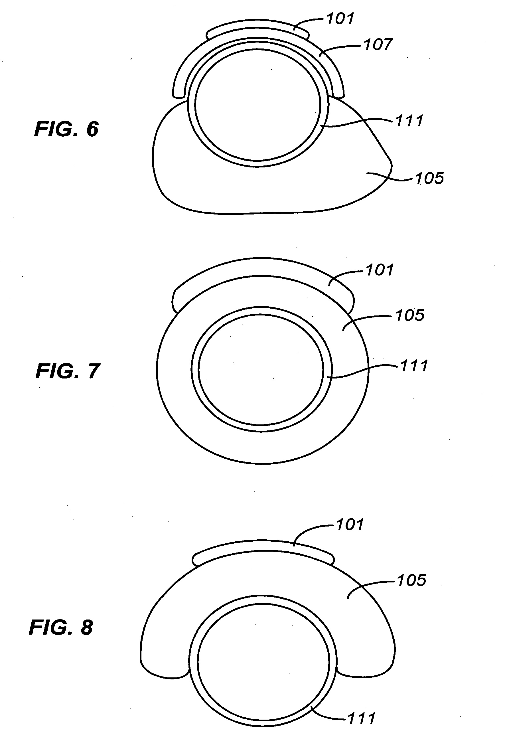 Precision ablating method