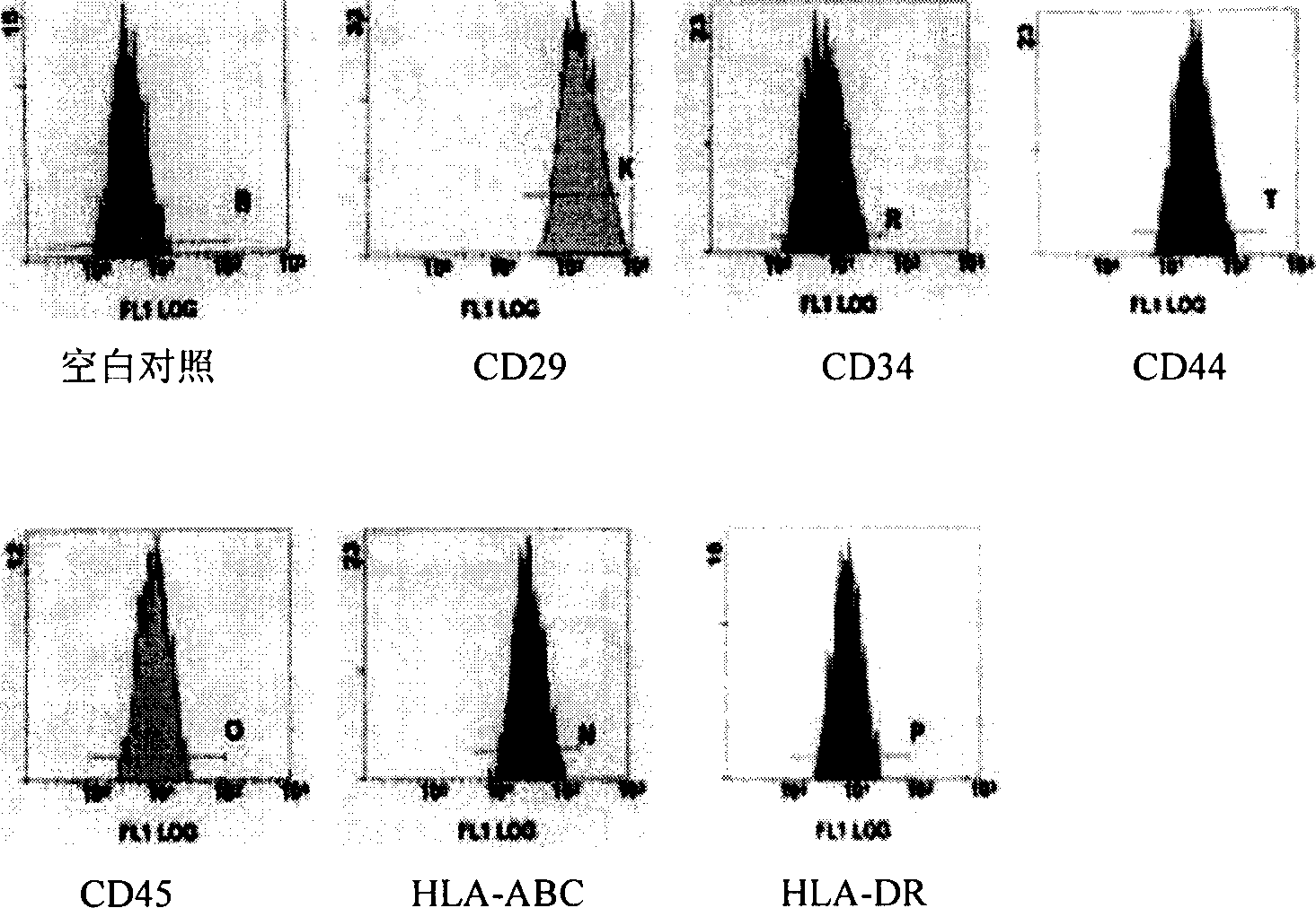 Method of inducing differentiation of human amnion mesenchyme stem cell to nerve cell