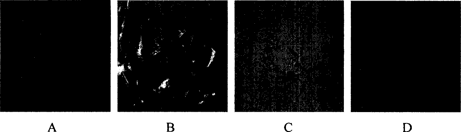 Method of inducing differentiation of human amnion mesenchyme stem cell to nerve cell