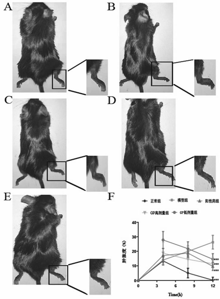 Application of fructus gardeniae and cortex platycladi decoction in preparation of medicine for treating acute gouty arthritis