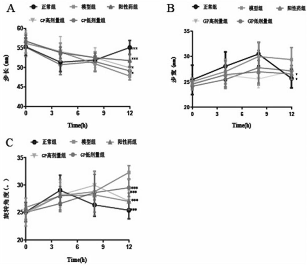 Application of fructus gardeniae and cortex platycladi decoction in preparation of medicine for treating acute gouty arthritis