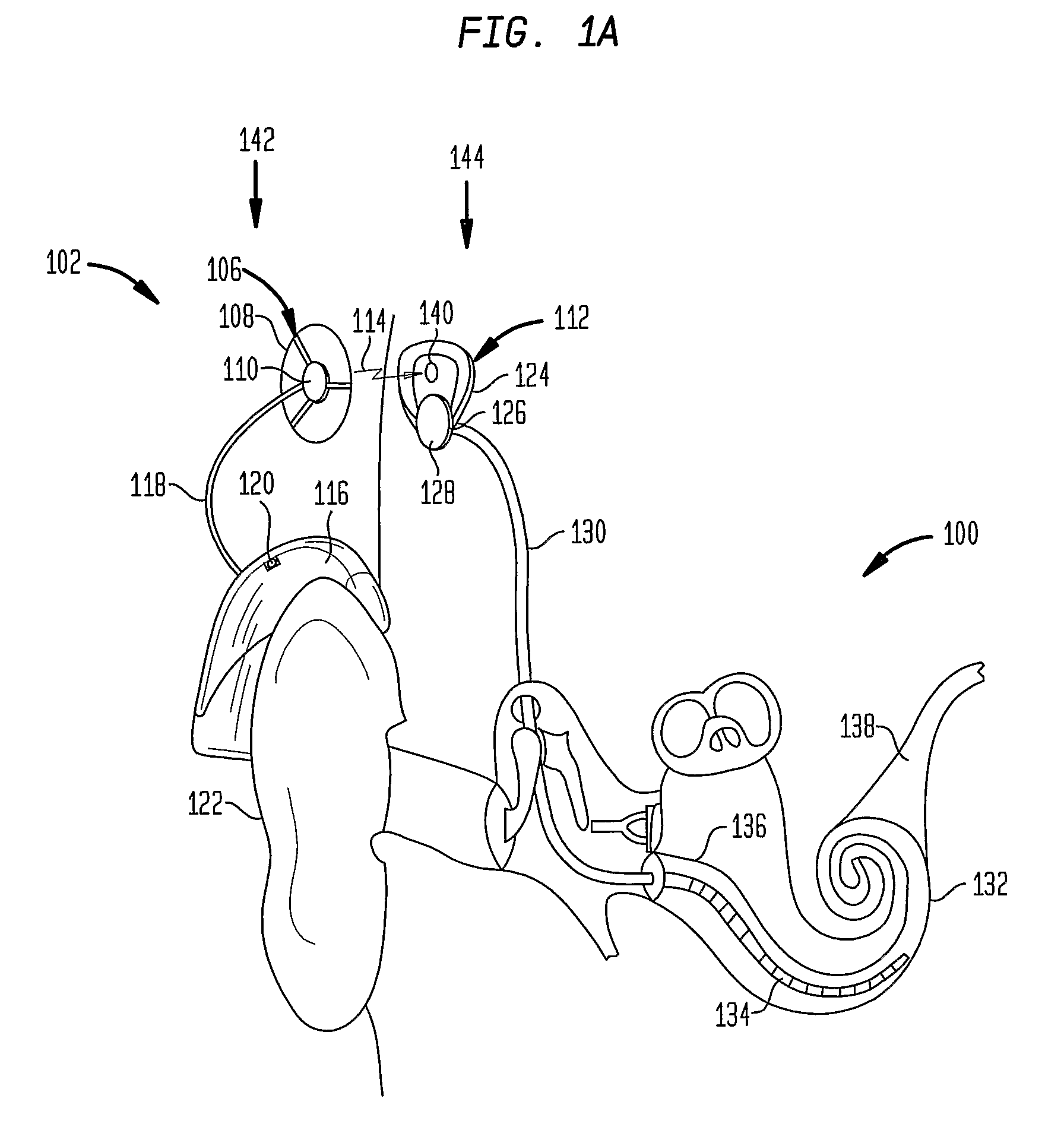 Transformable speech processor module for a hearing prosthesis