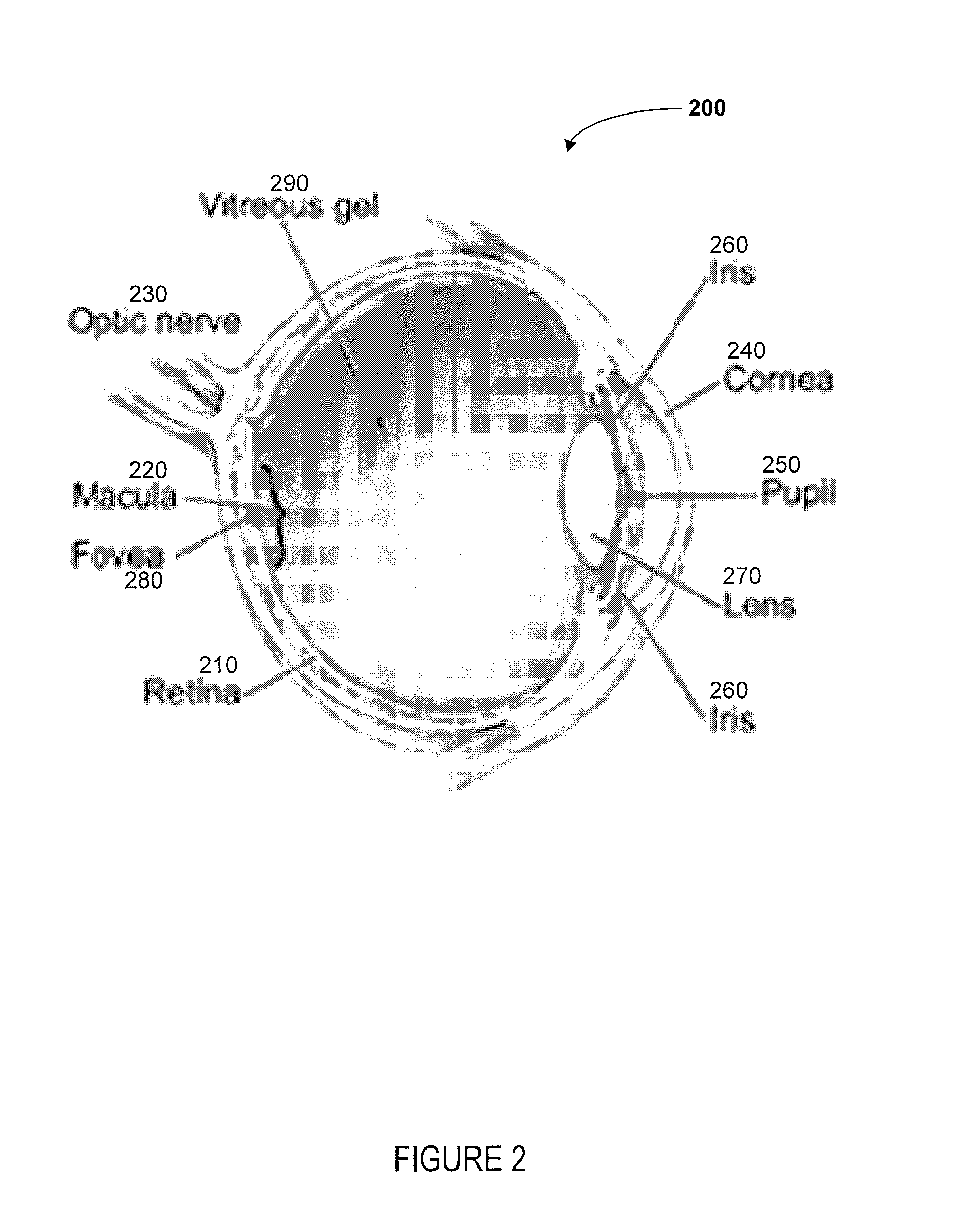 System and method for automated detection of age related macular degeneration and other retinal abnormalities