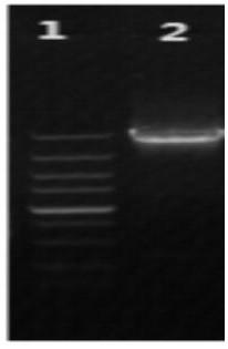 A kind of dextran sucrase and its application