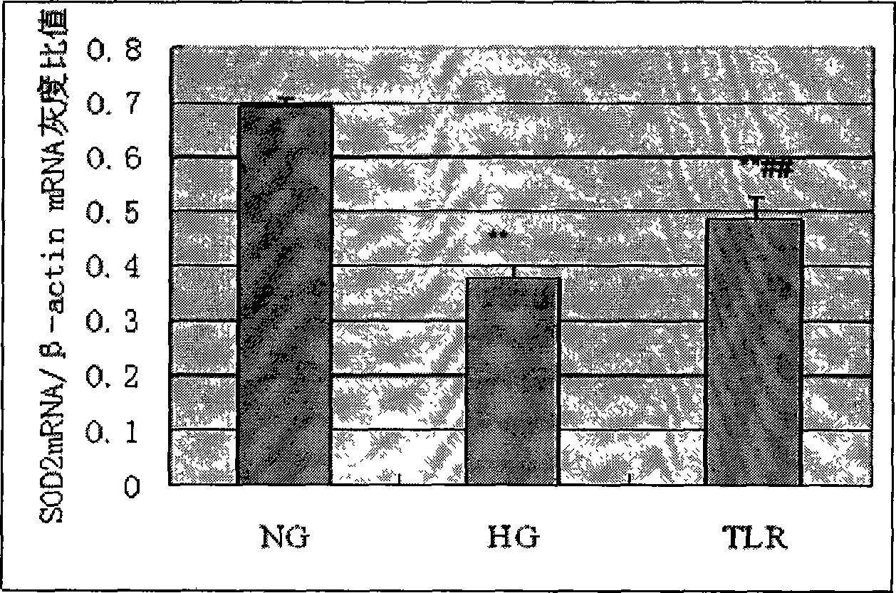 Use of traditional Chinese medicine in preparing medicine for treating diabetes cardiomyopathy