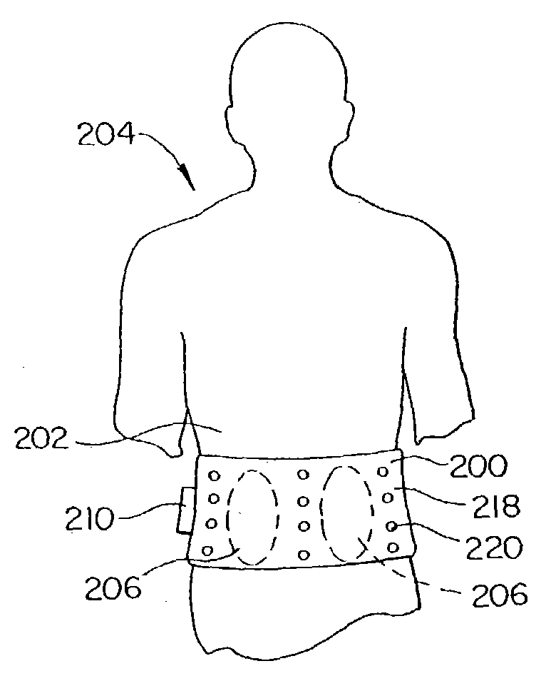 Orthoses