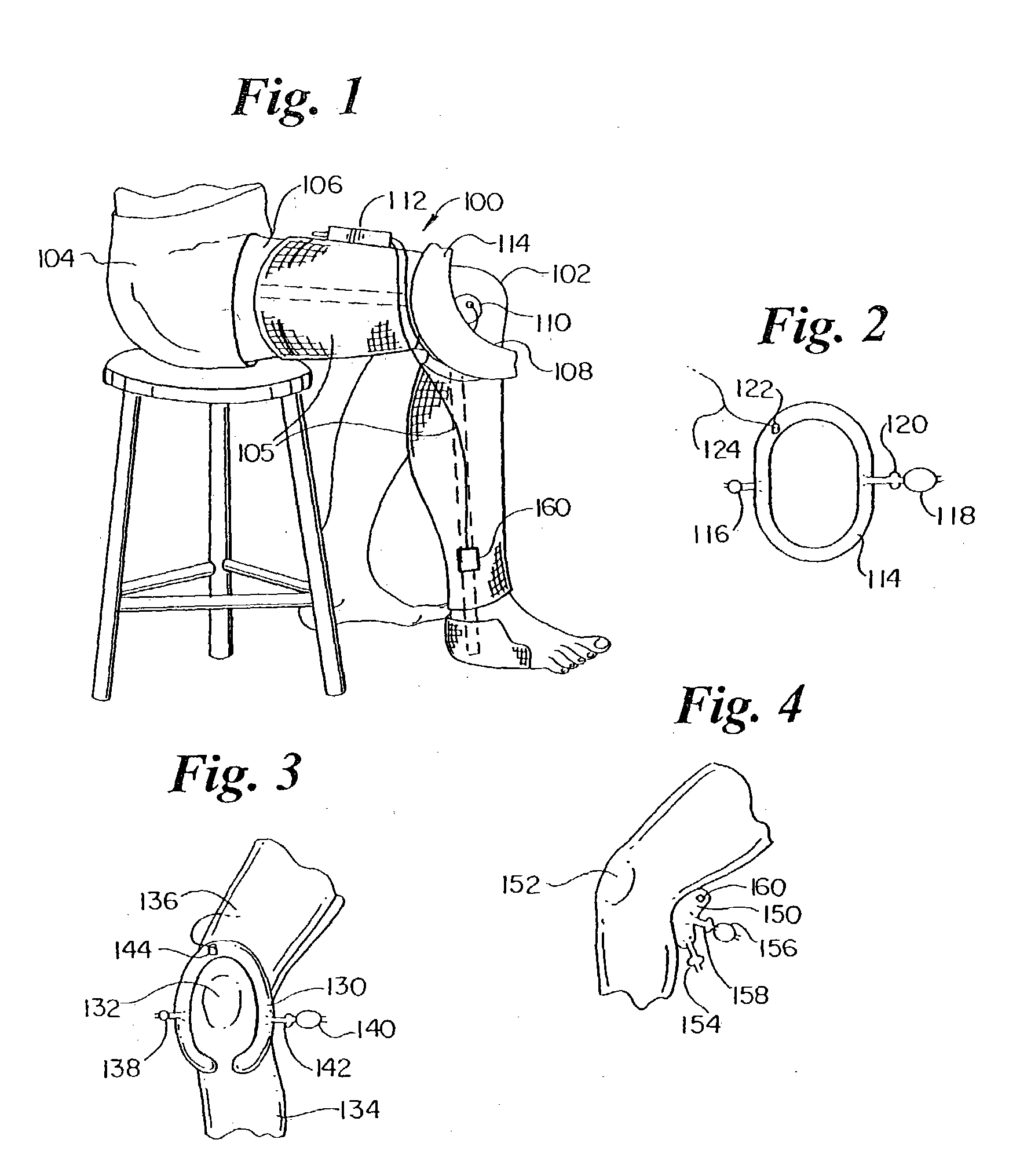 Orthoses