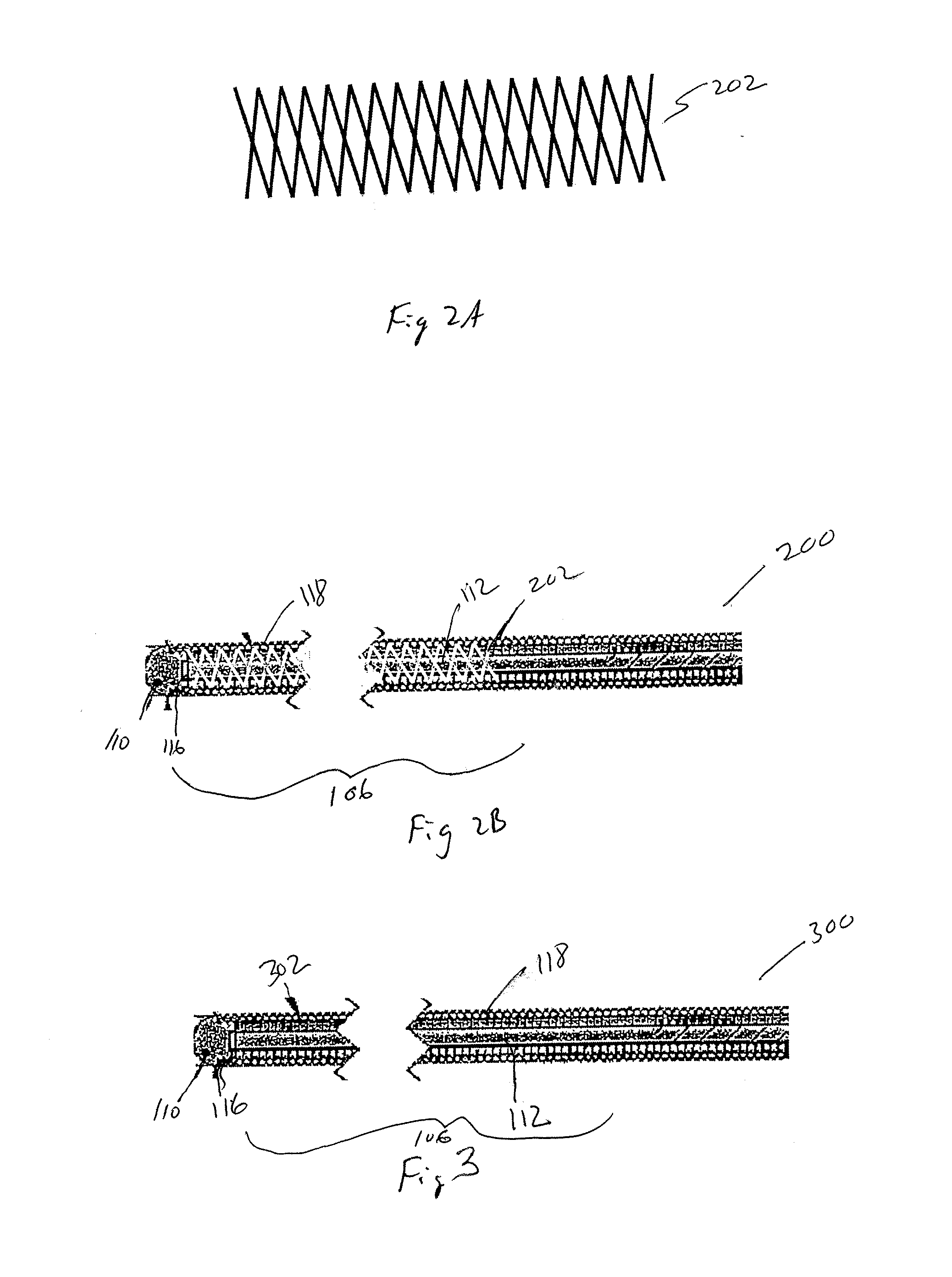 Reformable guidewire tip