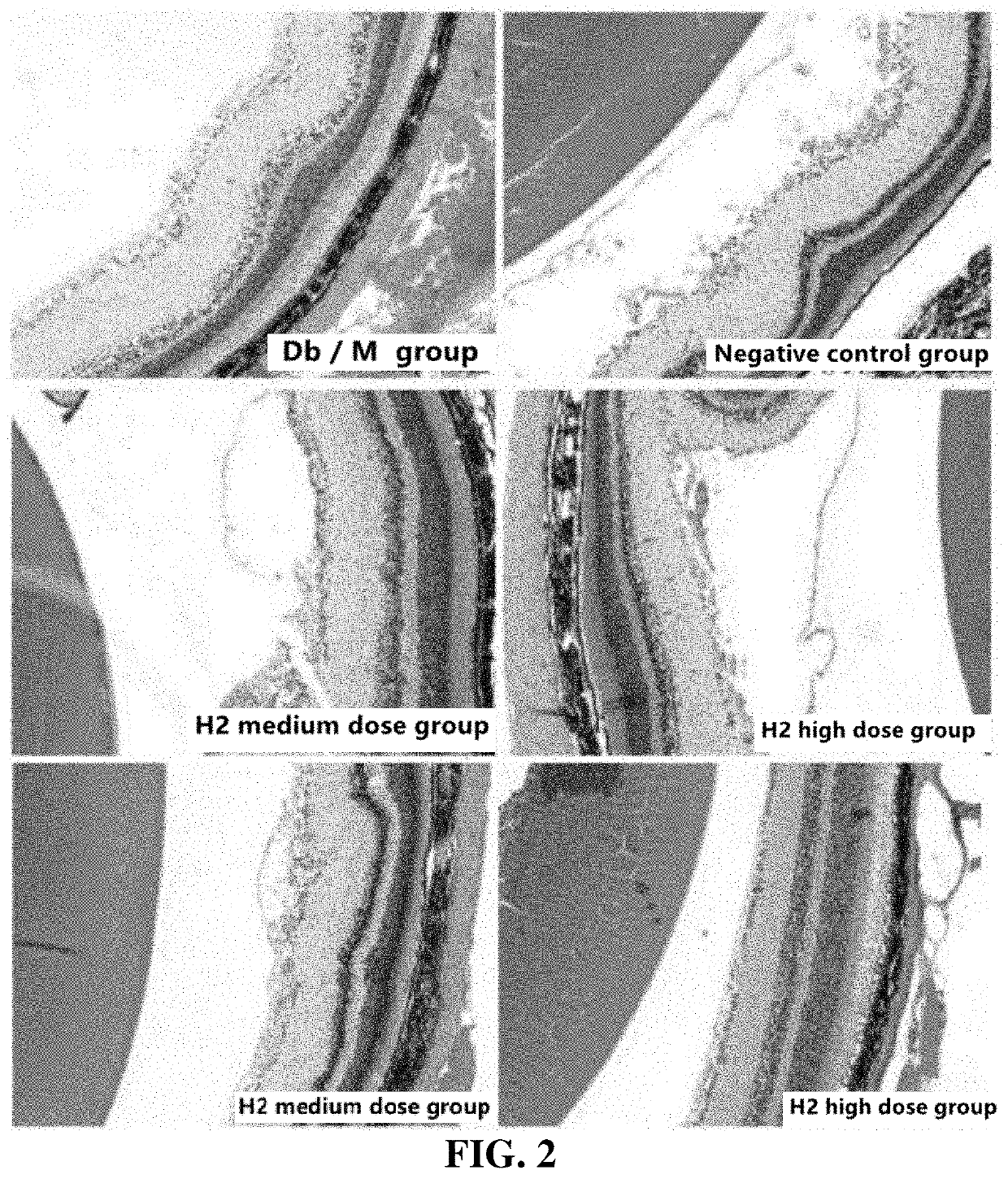 Application of glycosides in the preparation of drugs for preventing and treating diabetes complications