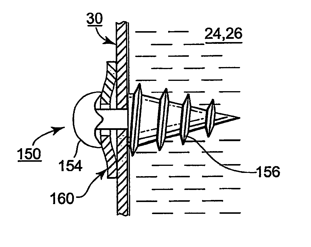 Methods and apparatus for securing a urethral sling to a pubic bone