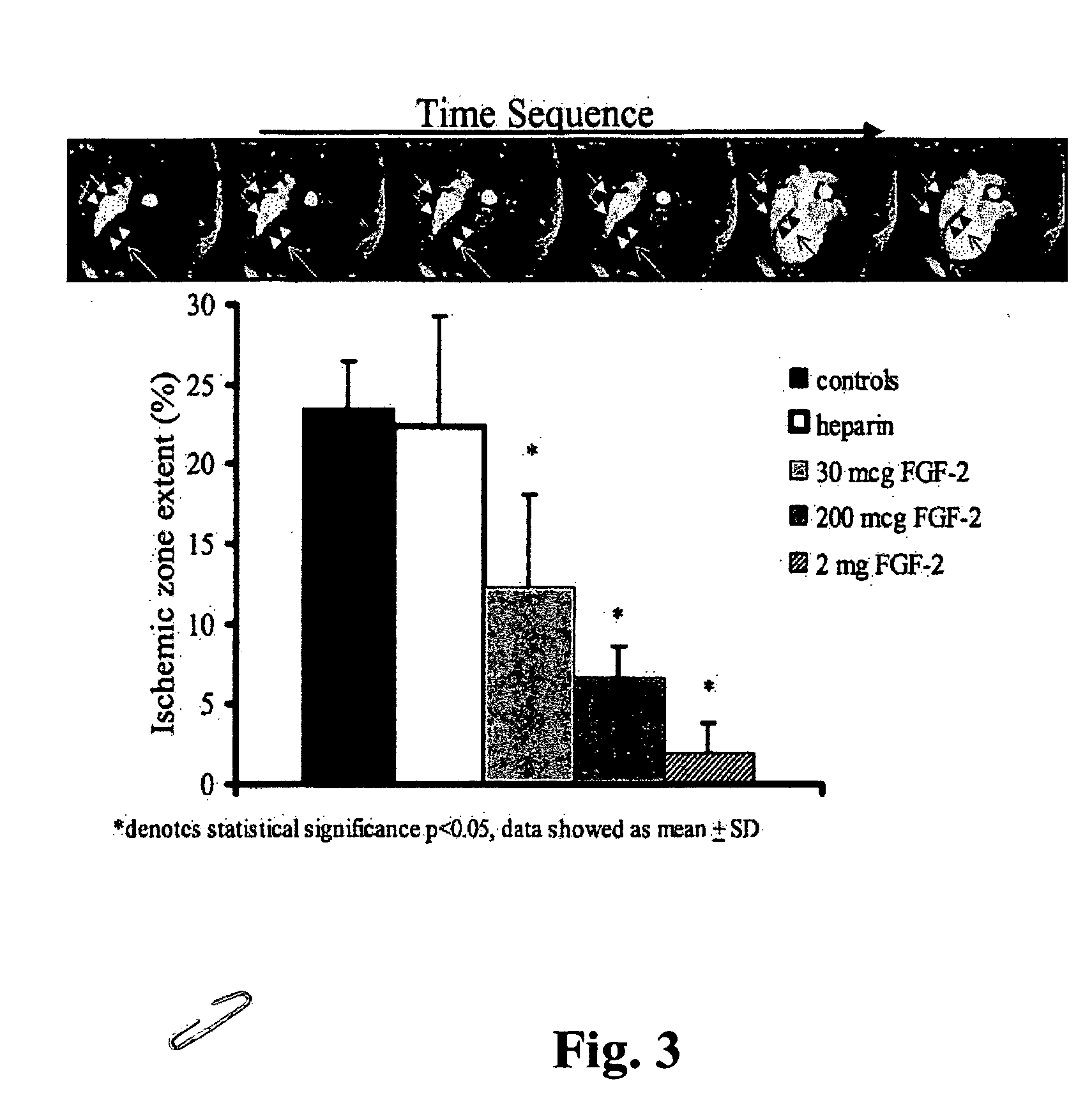 Growth factor therapy mobilization of stem cells into the periperal blood