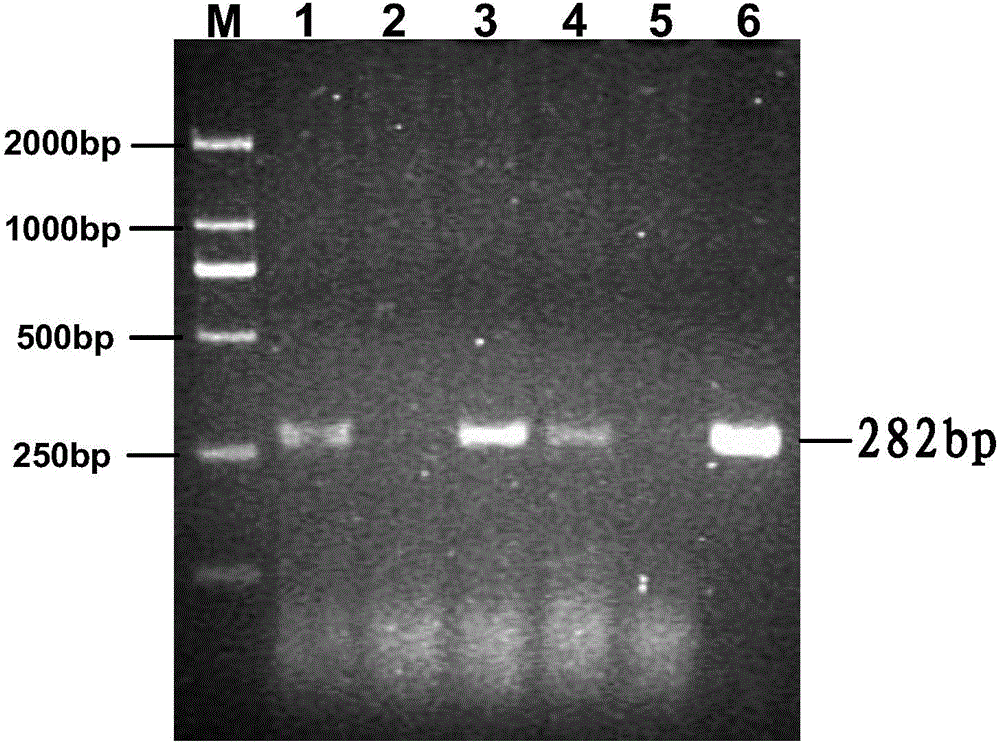 Fusion gene containing transmissible gastroenteritis virus (TGEV) and porcine epidemic diarrhea virus (PEDV) protective antigens as well as encoding protein and application thereof