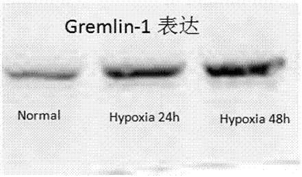 Application of Immortalized Human Lung Microvascular Endothelial Cell Compound Cytokines in the Preparation of Biological Preparations for Tissue Ischemia Damage Repair