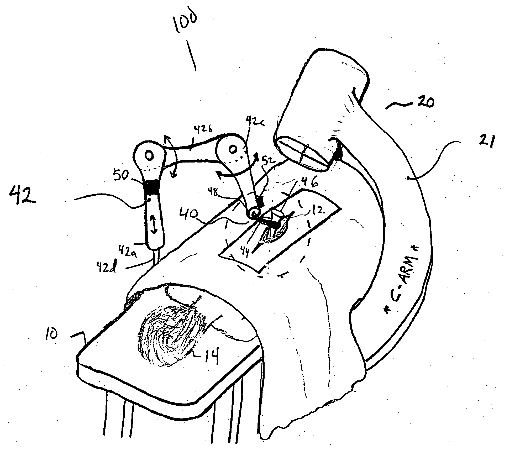 Rigidly guided implant placement