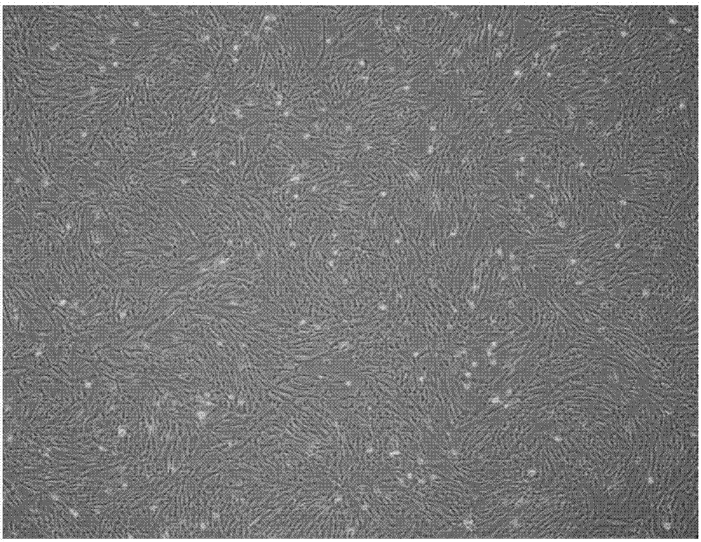 Body cream based on active factor extract secreted by human mesenchymal stem cells, and preparation method thereof