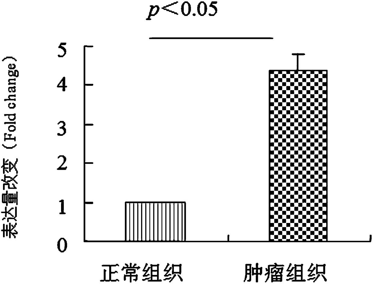 Application, kit and detection method for novel molecular marker non-coding RNA LINC00958 for lung cancer prognosis