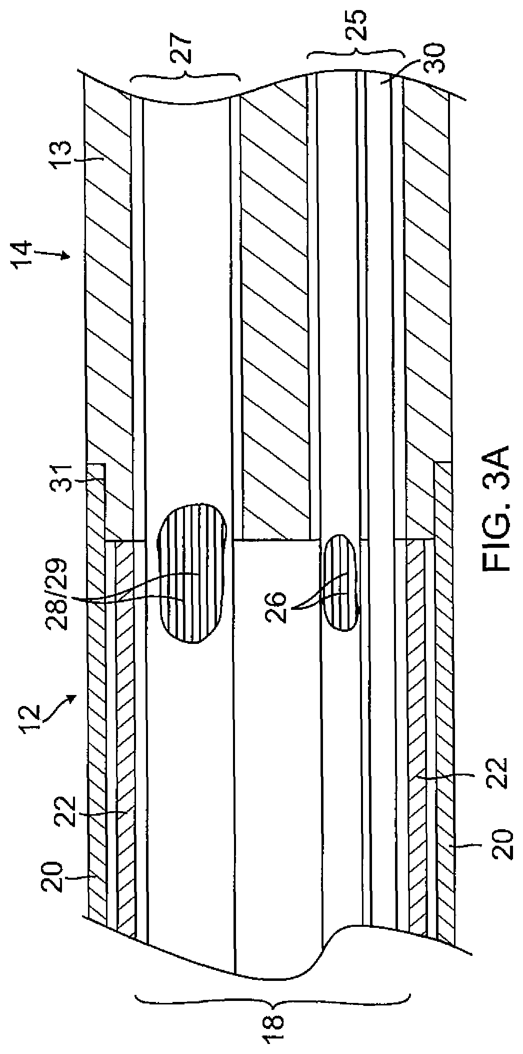 Pericardial catheter with temperature sensing array