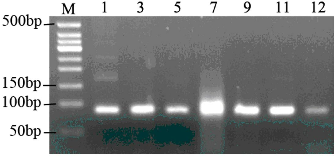 Aeromonas hydrophila aptamer, and screening method and application thereof