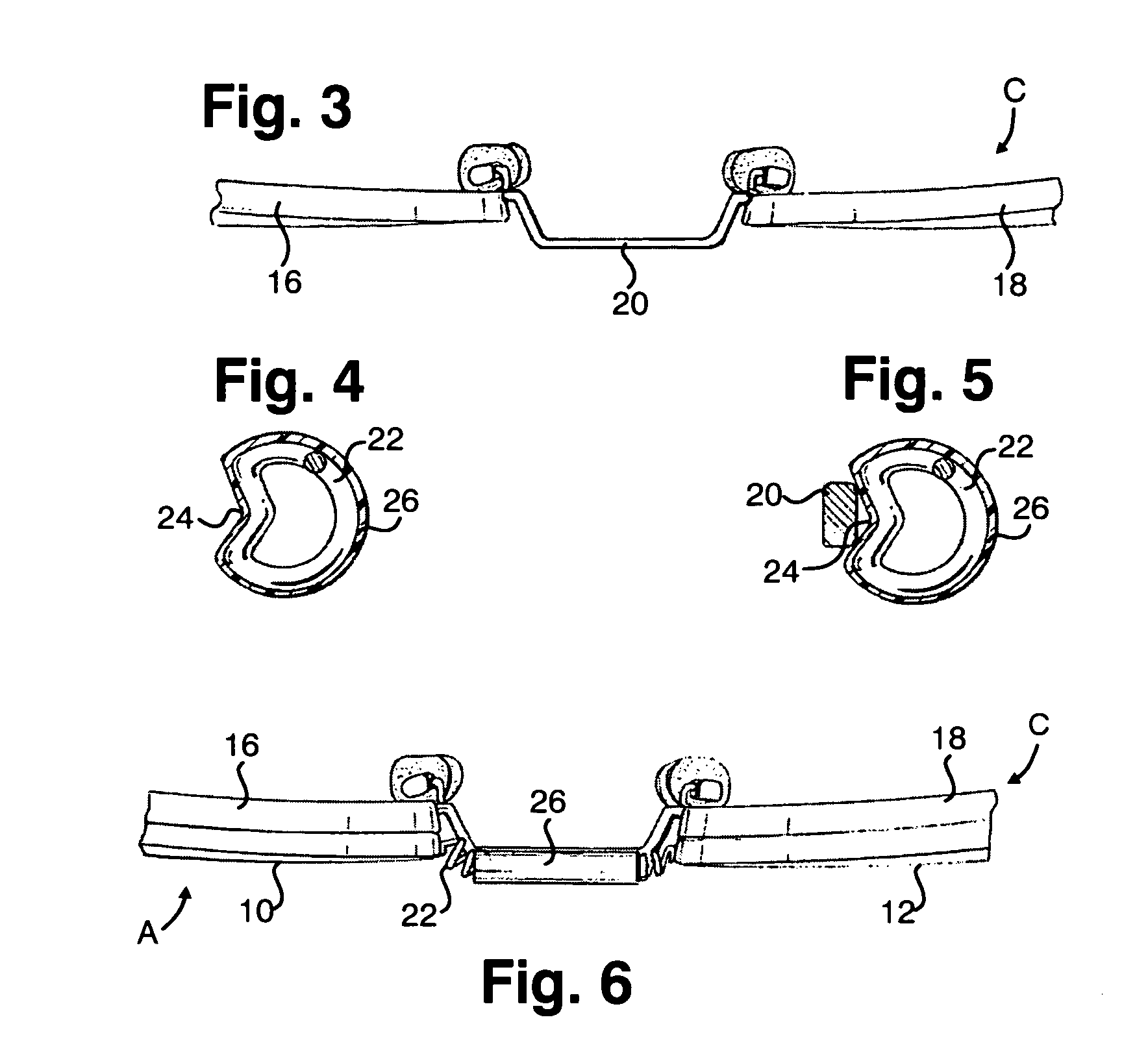 Clip-on with flexible and expandable bridge member