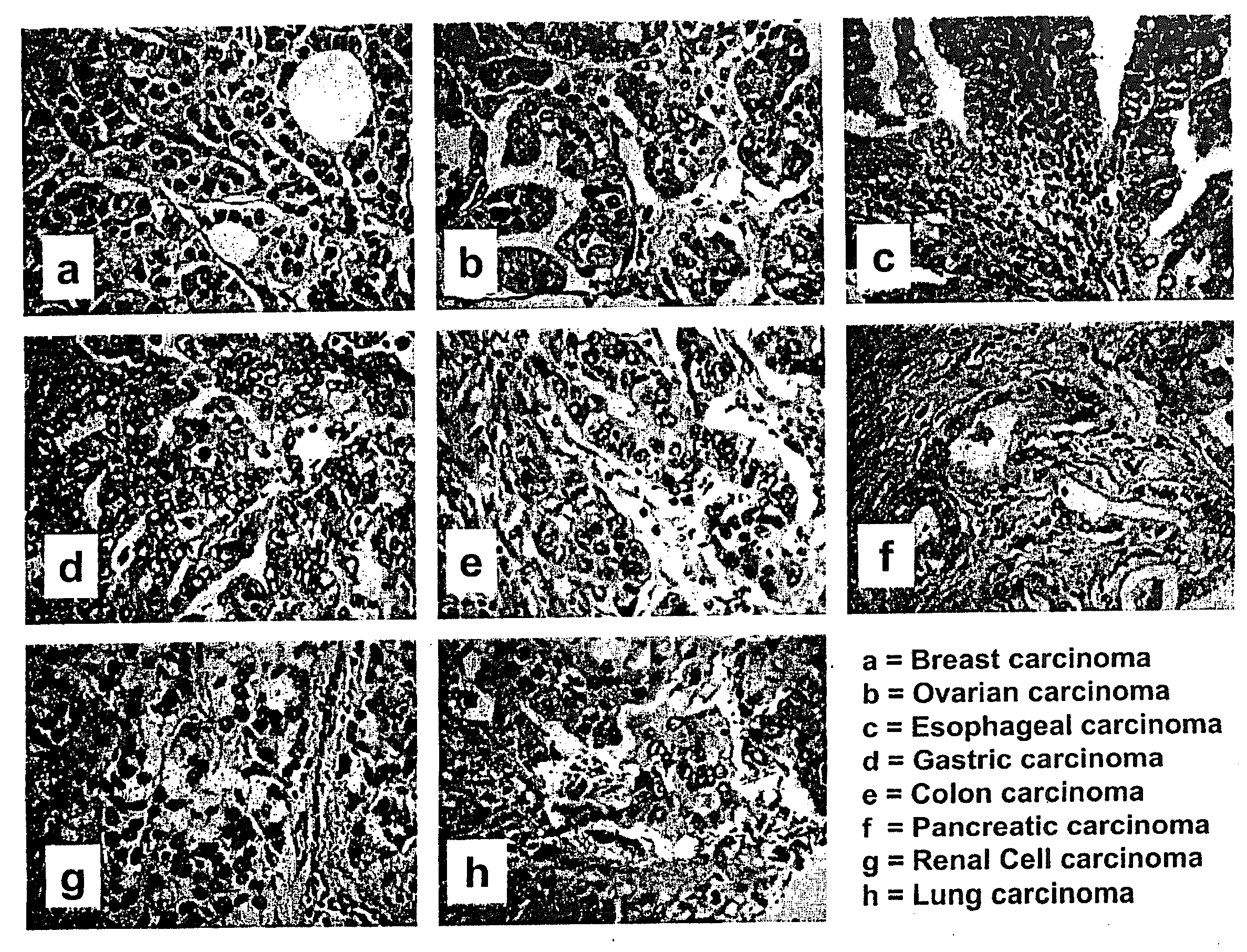 Tissue classification method for diagnosis and treatment of tumors