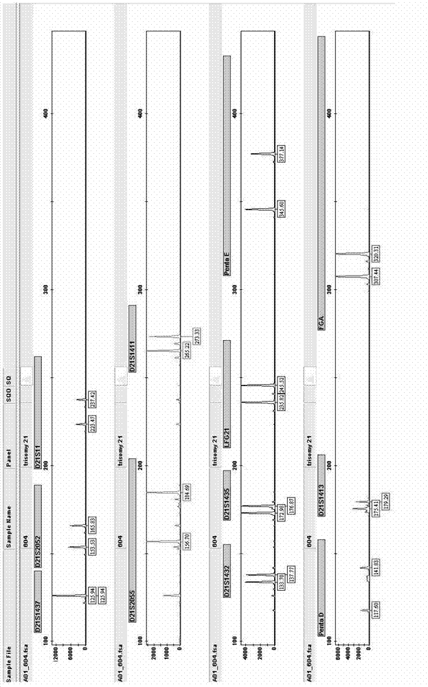 Amplification composition and rapid detection kit used for trisomy 21 syndrome detection