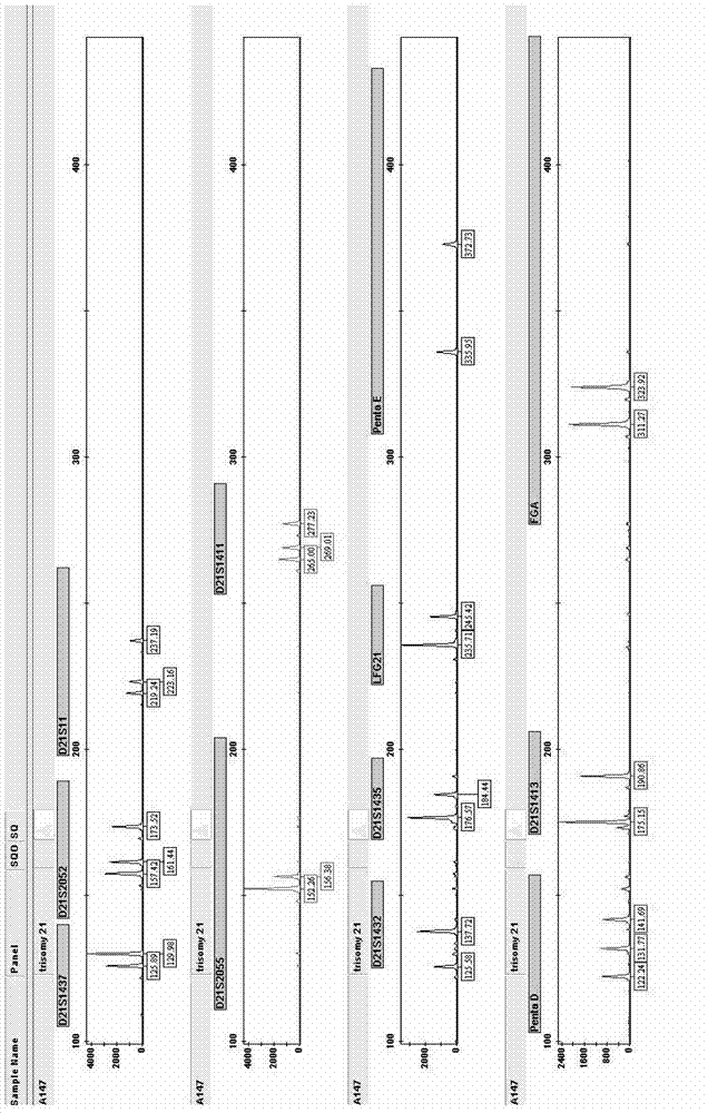 Amplification composition and rapid detection kit used for trisomy 21 syndrome detection