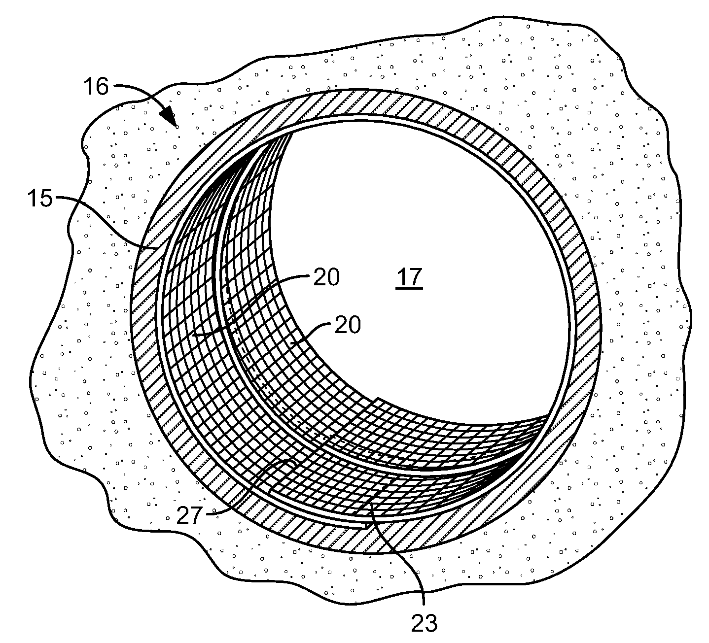 Apparatus and Method of Reinforcing a Conduit or Vessel